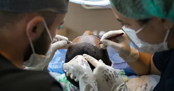 Plastisk kirurgi og hårtransplantasjon