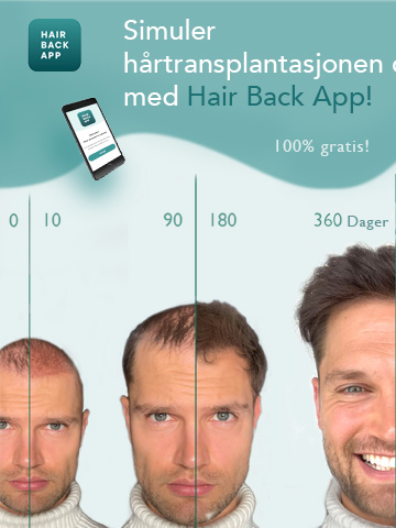 Hair_loss_app_preview